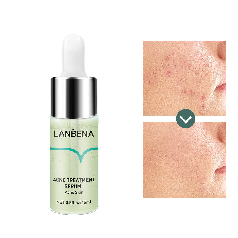 Lambina Anti-acne Original Liquid For Anti-acne Repair And Diminish Acne Marks