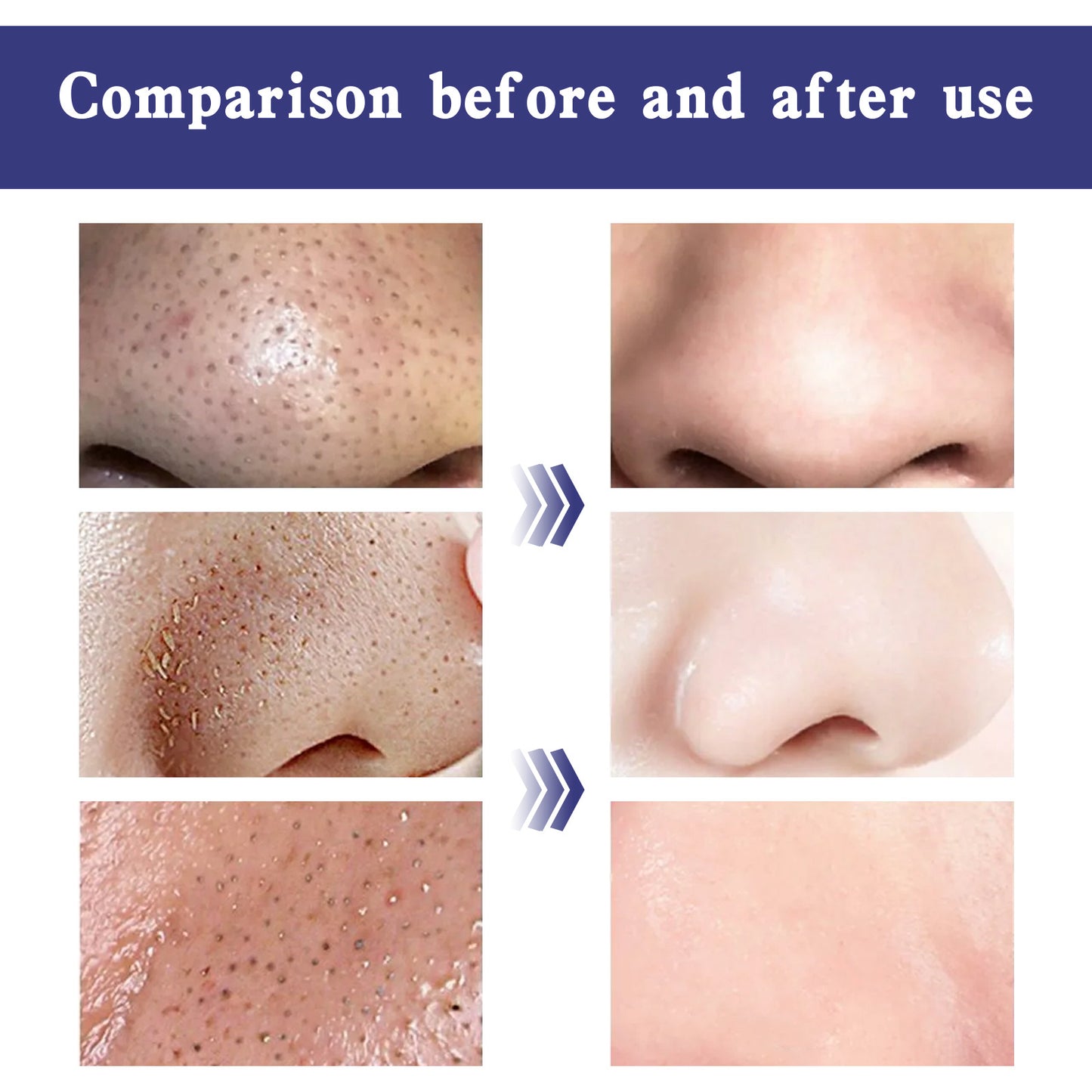 Deep Pore Cleaning Paste Closed Mouth Firming Care
