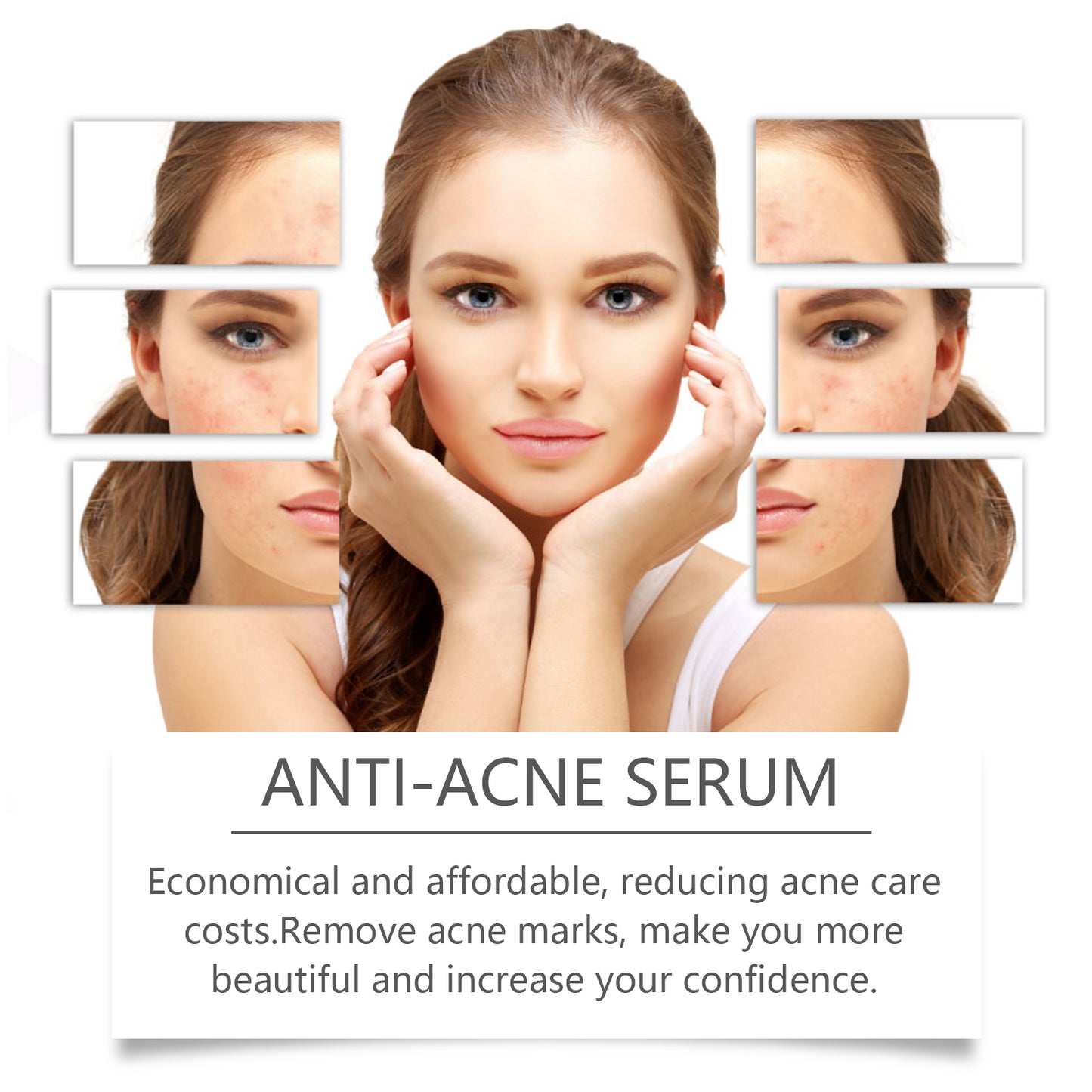 Hoygi Nicotinamide Anti-Acne Serum Mild Anti-Acne Serum Improve Acne Moisturizing Repair Serum