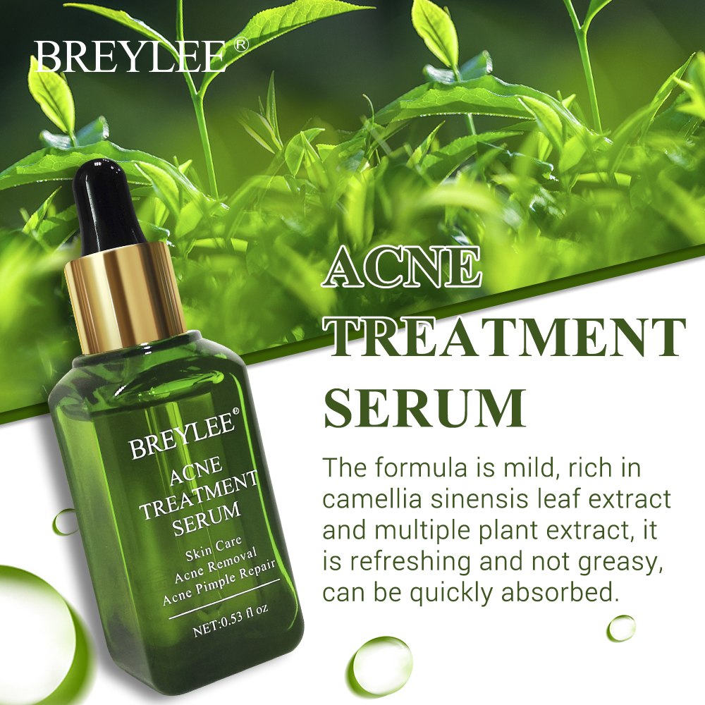 7f472800b53e7d744d2fd6518b31cfad