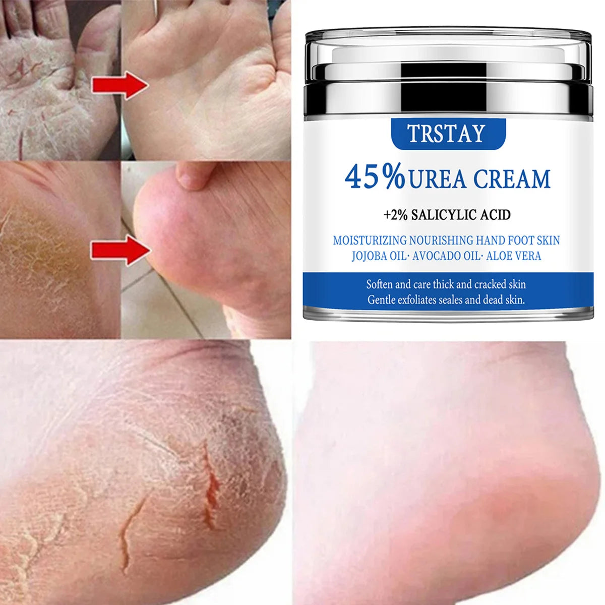 TRSTAY 45% urea cream+2% salicylic acid moisturizes and nourishes hand and foot skin with jojoba oil, avocado oil, and aloe vera