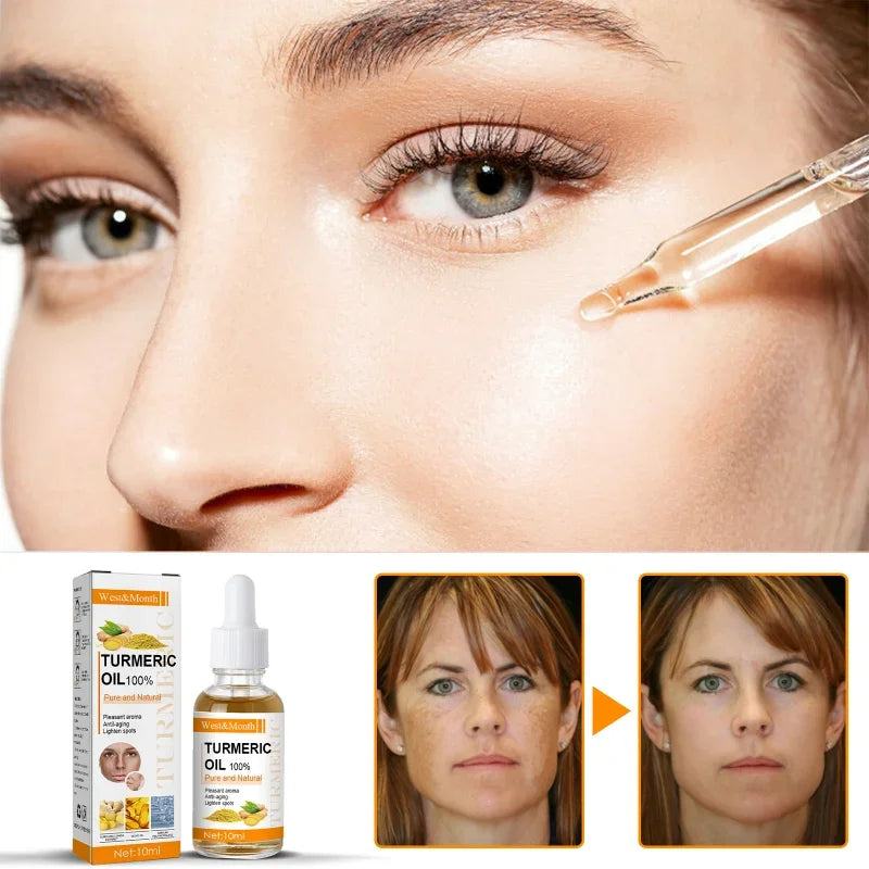Remove Dark Spots Turmeric Essential Oil Anti Wrinkle Face Serum Therapeutic Acne Shrink Pores Whitening Moisturizing Skin Care