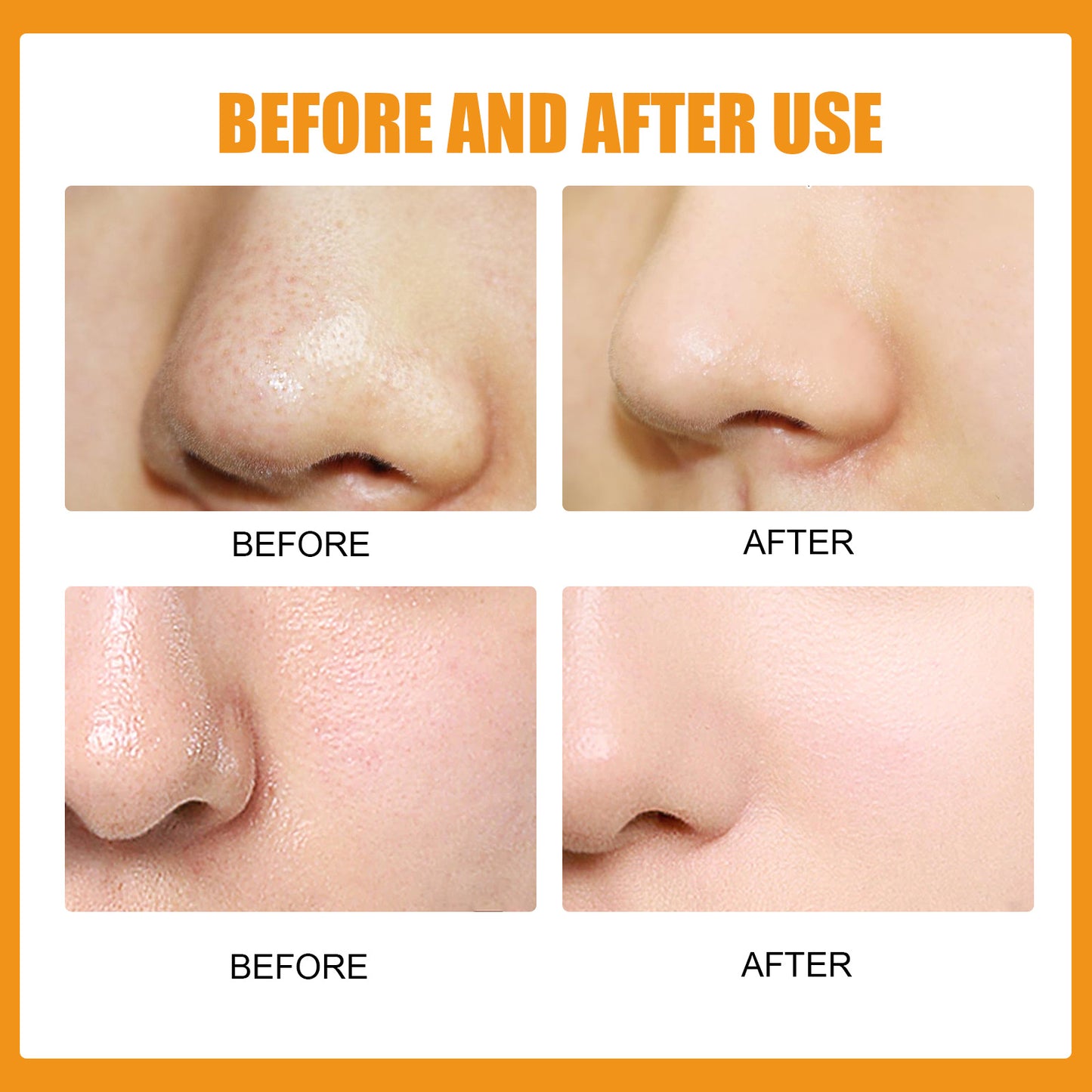 Nose Stick Clean Pore Gentle Care Peel